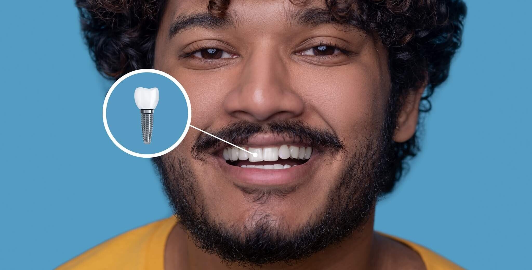 young-man-with-toothy-smile-demonstrating-his-dental-implant